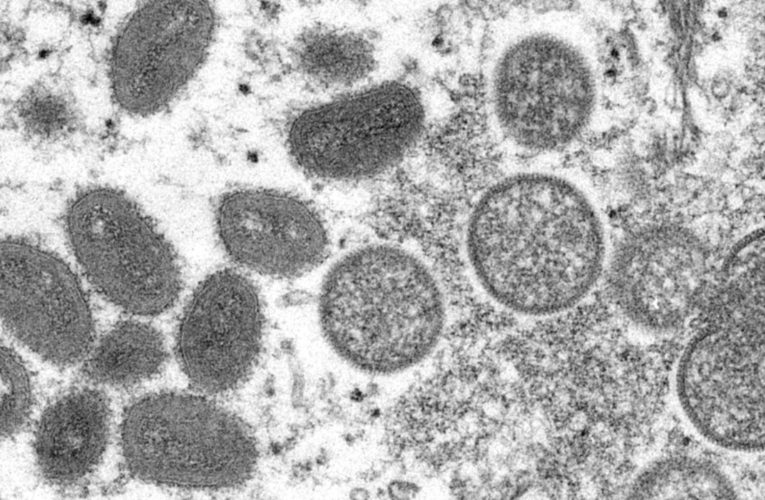 WHO meeting over monkeypox virus spread: report