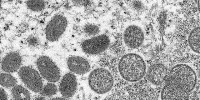 This 2003 electron microscope image made available by the Centers for Disease Control and Prevention shows mature, oval-shaped monkeypox virions, left, and spherical immature virions, right, obtained from a sample of human skin associated with the 2003 prairie dog outbreak. Monkeypox, a disease that rarely appears outside Africa, has been identified by European and American health authorities in recent days.