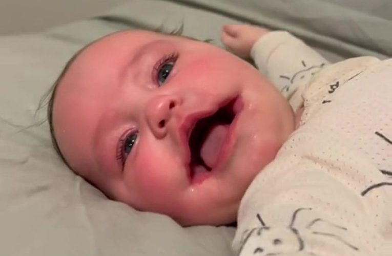 Our baby was born with a rare ‘permanent smile’ condition