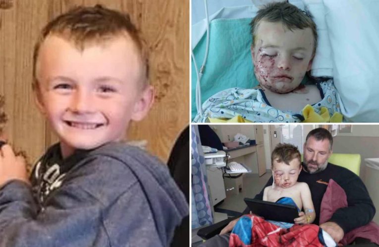 Michigan boy Hunter Callender suffers gruesome injuries after mauled by pitbulls