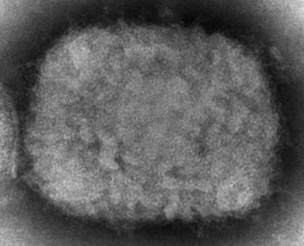 monkeypox virus