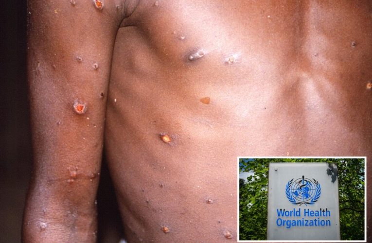 WHO convening emergency meeting on monkeypox