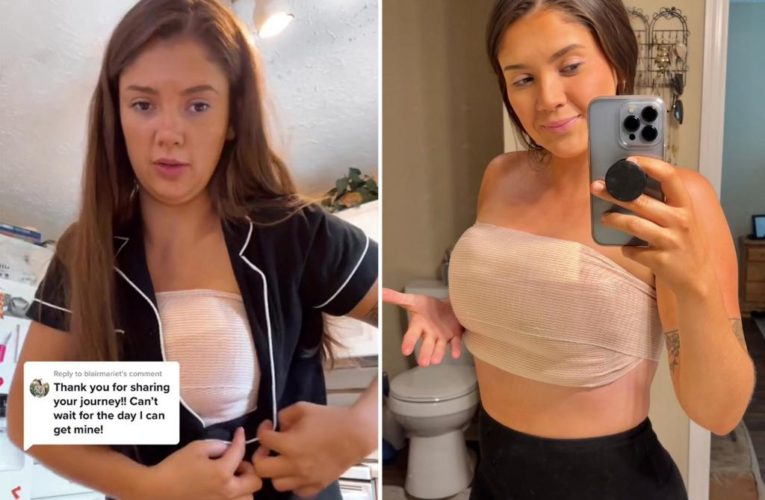 My 34E breasts caused my spine to curve — now I’m getting surgery