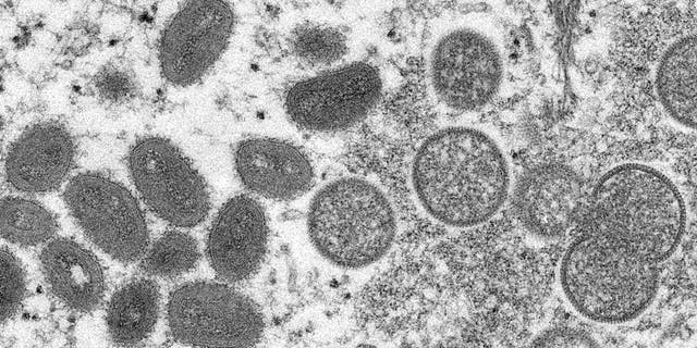 This 2003 electron microscope image made available by the Centers for Disease Control and Prevention shows mature, oval-shaped monkeypox virions, left, and spherical immature virions, right, obtained from a sample of human skin associated with the 2003 prairie dog outbreak.