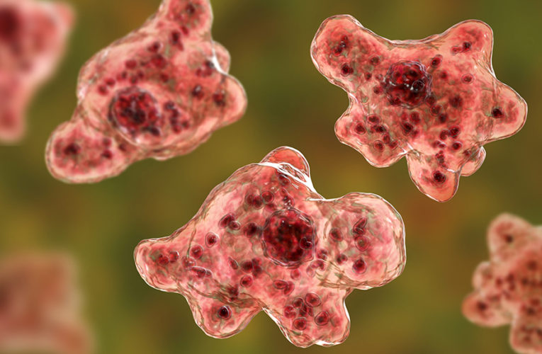 Florida teen reportedly contracts ‘brain-eating amoeba’ after swimming