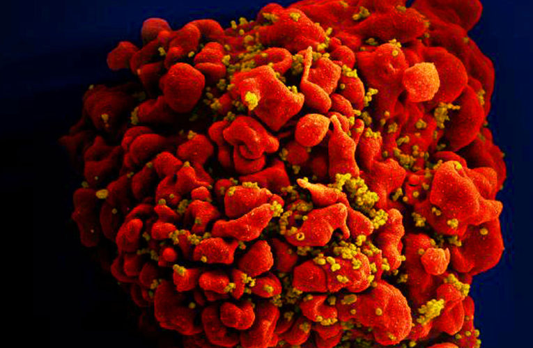 66-year-old HIV patient becomes the oldest person to be cured after stem cell transplant