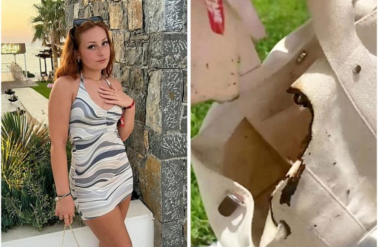 Woman’s bag bursts into flames after it’s left in the sun