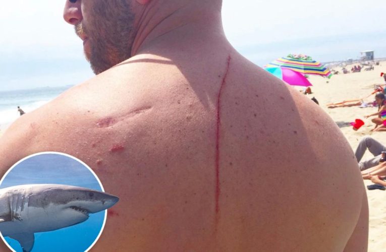 A shark attack saved me from dying of cancer