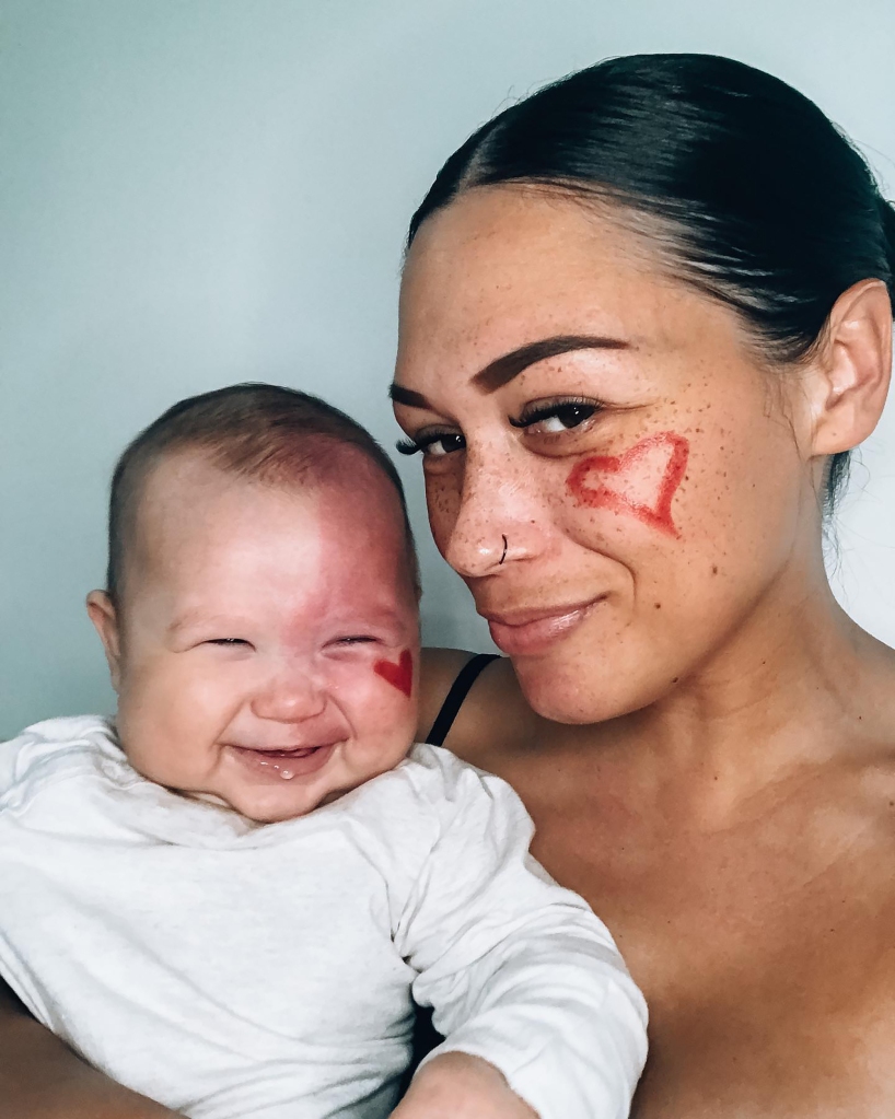 Atkins was called a  “monster” for choosing to laser her baby’s large facial birthmark.