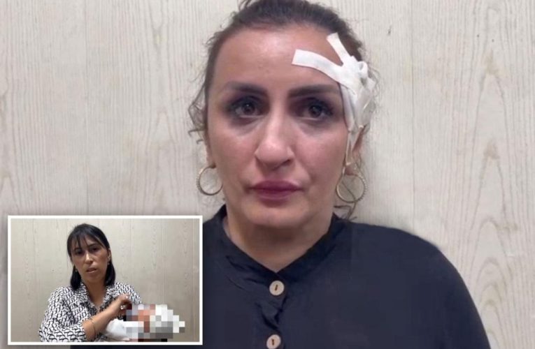 Mom busted for selling newborn baby to pay for $3,600 nose job