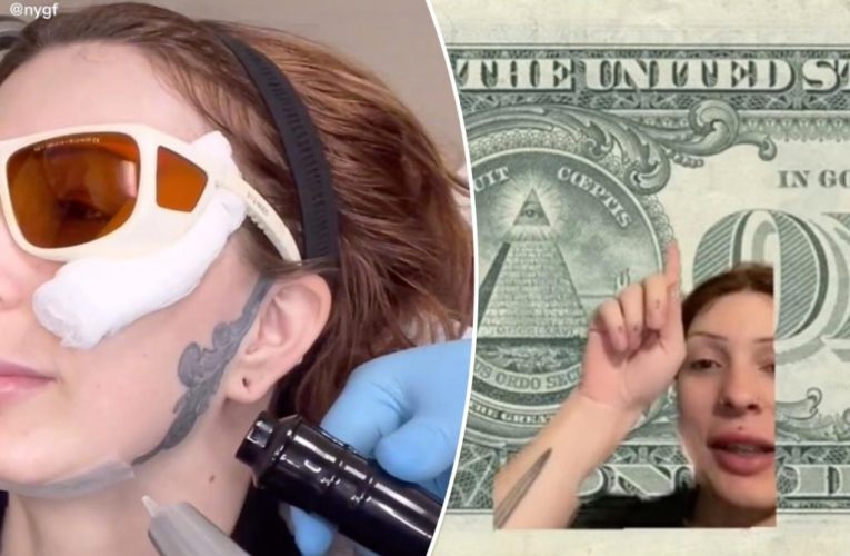 I let tattoo artist ink my face with surprise — now I’m ashamed