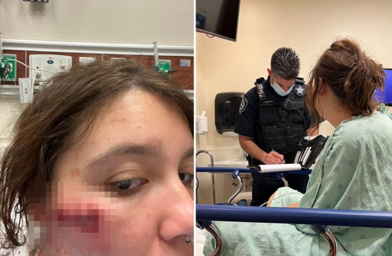 Highland Park shooting survivor shares images of injuries