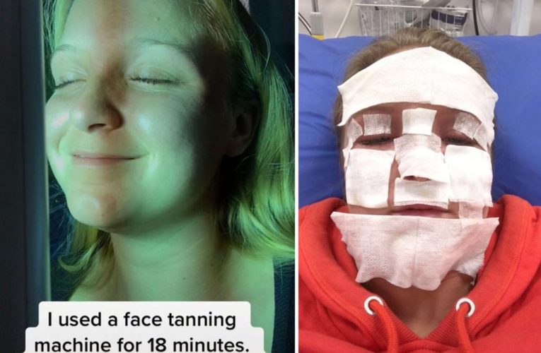 Influencer Emma Hoffstrom sent to hospital from tanning bed