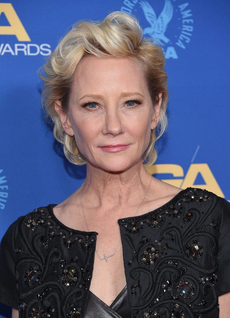 Anne Heche was severely burned from a crash that may also cost her a DUI.