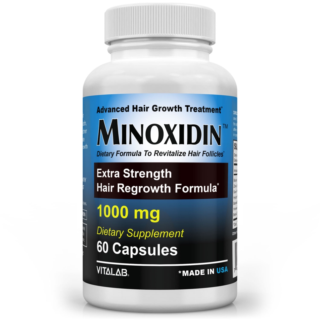 Generic hair loss drugs containing minoxidil are becoming increasingly popular.