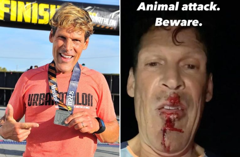 Ultramarathon runner Dean Karnazes attacked by coyote on 150-mile run in California