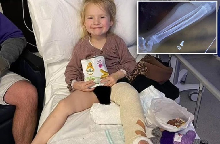 Australian 4-year-old breaks both legs on slide