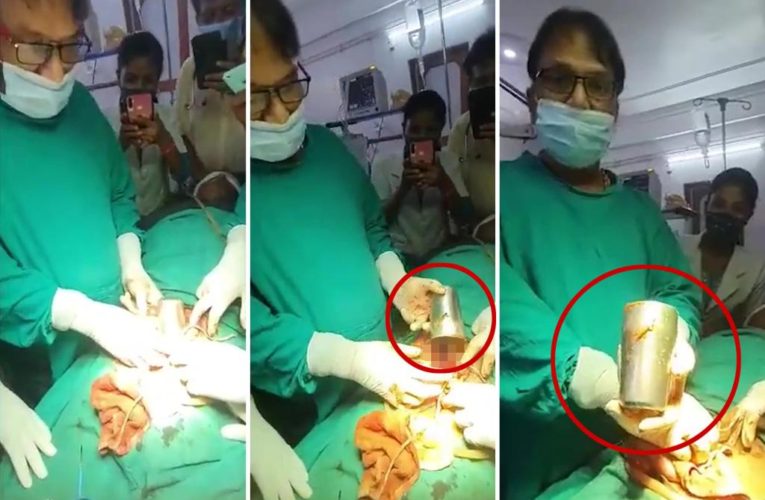 Doctors stunned to discover steel cup in drunk man’s stomach