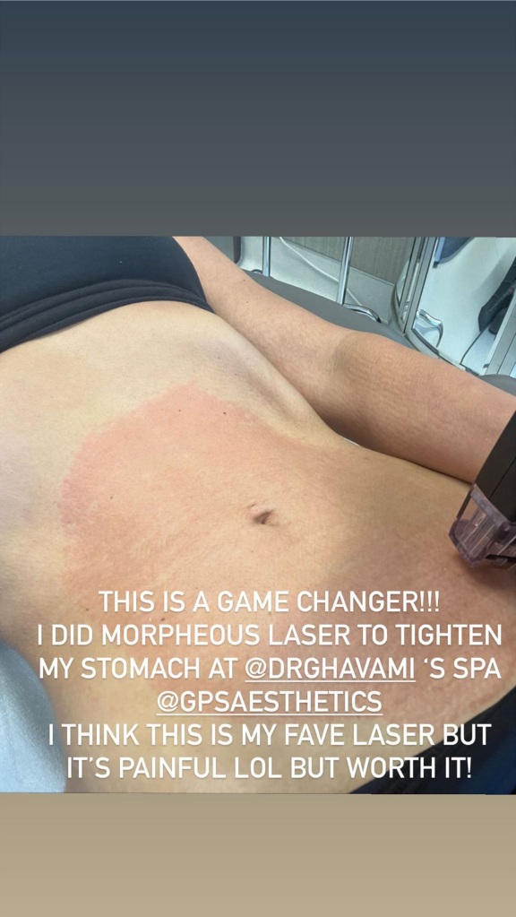 Kim Kardashian Instagram story of her stomach