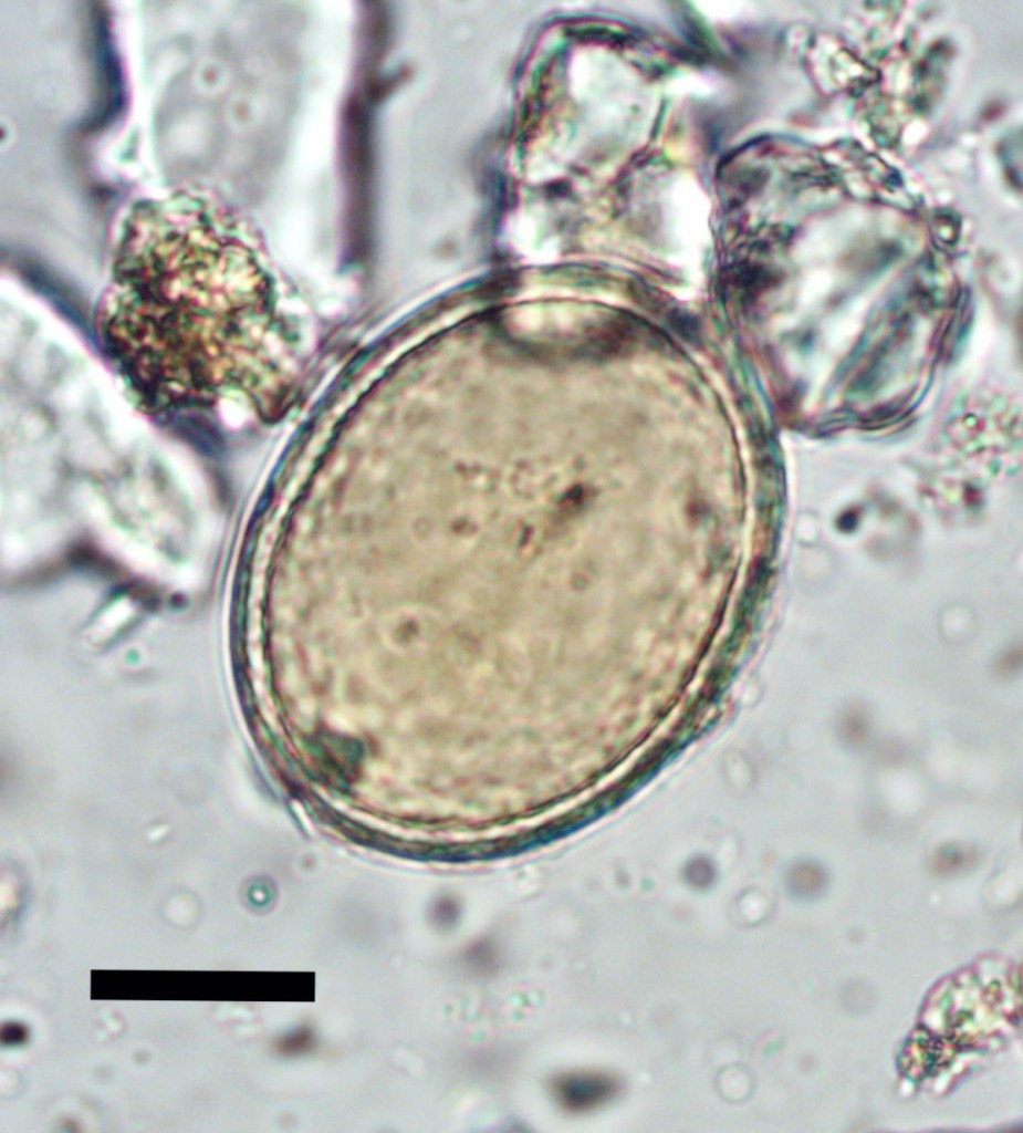 roundworm egg