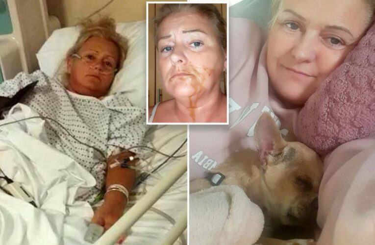 Woman hospitalized after dog poos on her face while sleeping