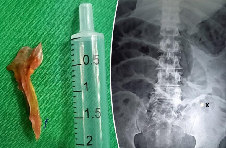Farmer dies after accidentally swallowing inch-long fish bone