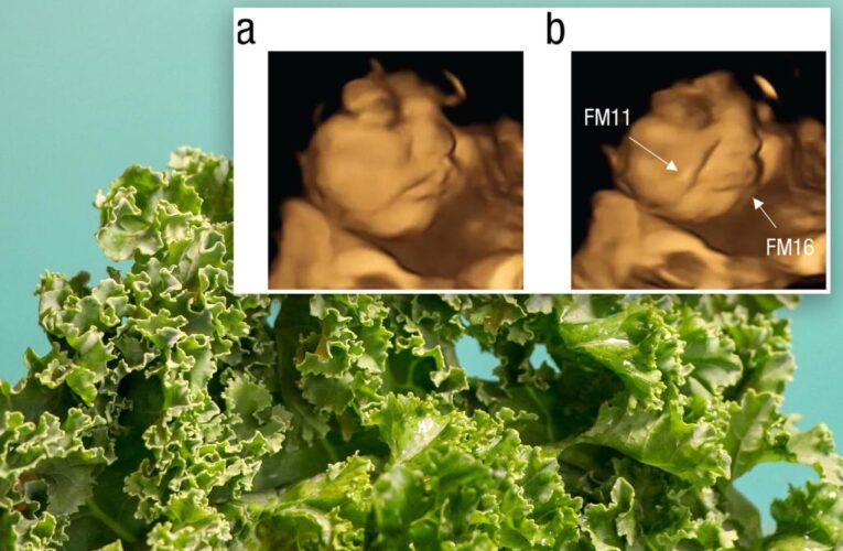 Taste of kale makes unborn babies grimace, study shows