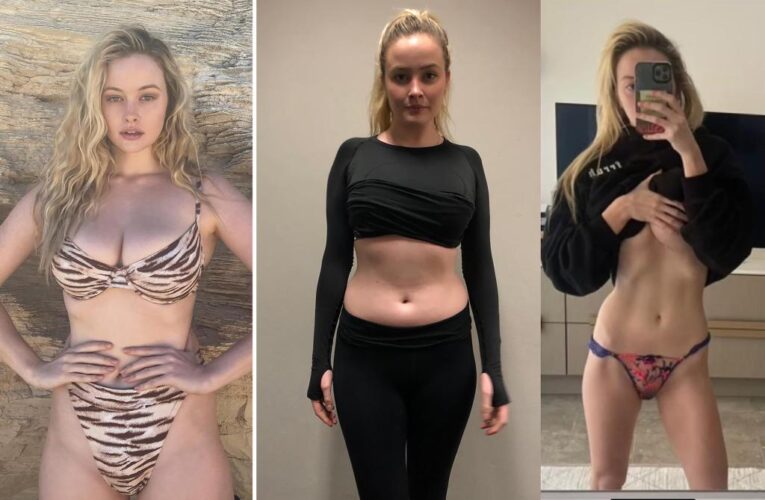 Simone Holtznagel’s before-and-after weight loss pics worry fans