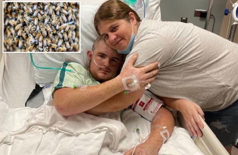 Ohio man Austin Bellamy out of coma after stung by bees 20,000 times