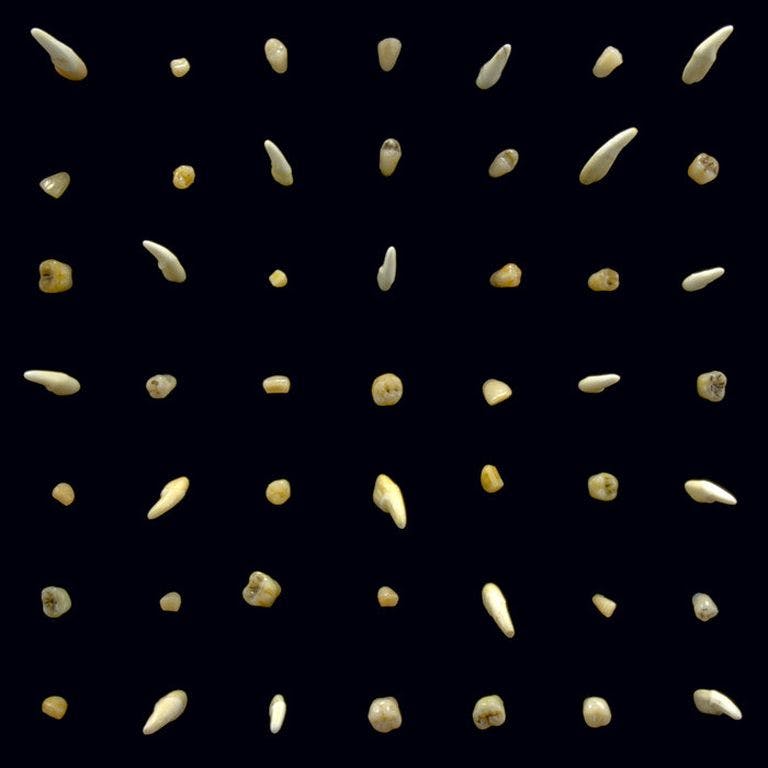 Rows of teeth against a black background