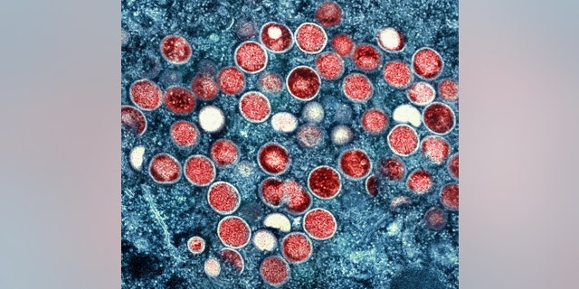 This image provided by the National Institute of Allergy and Infectious Diseases (NIAID) shows a colorized transmission electron micrograph of monkeypox particles (red) found within an infected cell (blue), cultured in the laboratory that was captured and color-enhanced at the NIAID Integrated Research Facility (IRF) in Fort Detrick, Md. 