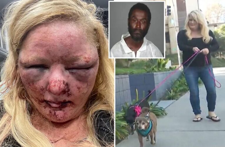 California woman recounts horrifying attack by homeless man