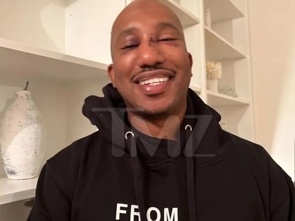 'SNL' alum Chris Redd is smiling through the pain after being attacked in New York City ... his nose is stitched up and his eyes are swollen and bruised.
