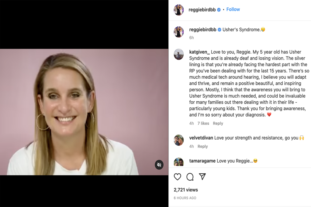 Reggie Bird explains what Usher syndrome is in a recent video posted to her Instagram, as fans rushed to the comment section in support of the Big Brother winner.