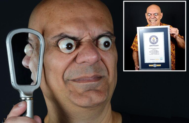 Man breaks world record for farthest eyeball pop