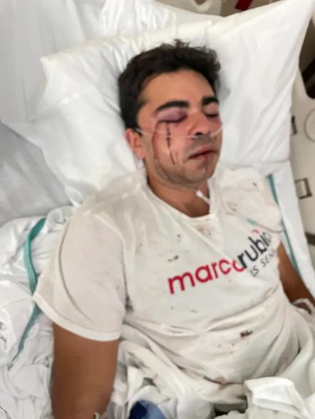 Police in South Florida has said there is no indication that the attack on a Sen. Marco Rubio supporter was politically motivated.
