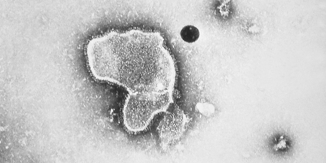 This transmission electron micrograph reveals the morphologic traits of the respiratory syncytial virus (RSV), 1981. 