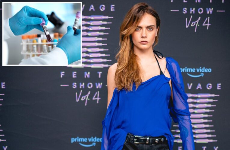 Why Cara Delevingne ‘donated’ an orgasm to science — and how she did it