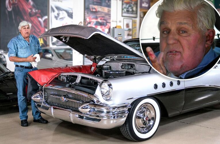 Jay Leno spotted behind the wheel after gas fire injuries