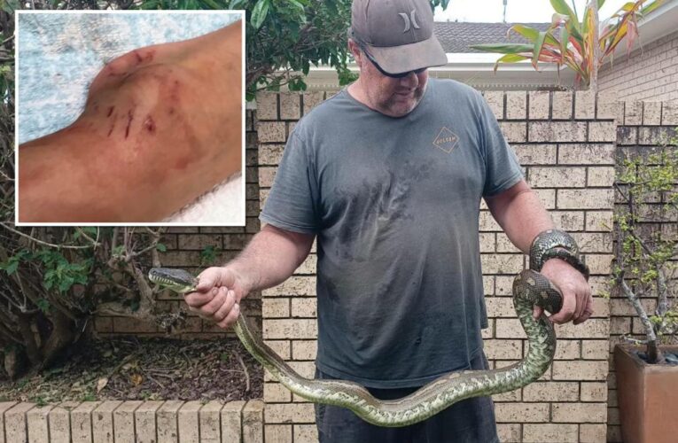 Python bites and drags 5-year-old Australian boy into pool