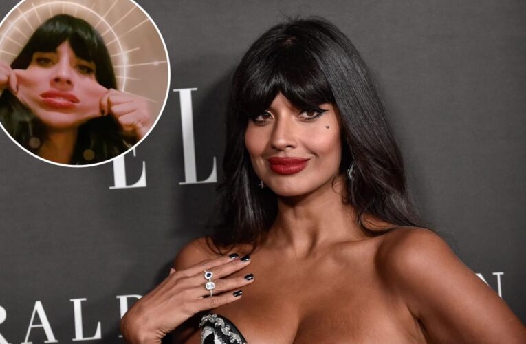 Jameela Jamil reveals rare tissue disorder battle, says haters made her ‘suicidal’