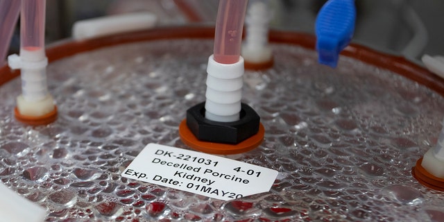 A label on a bioreactor indicates it contains a pig kidney in a Micromatrix laboratory on Tuesday, Dec. 8, 2022, in Eden Prairie, Minn.