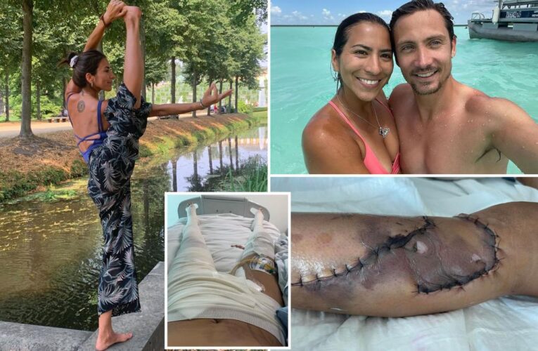 Yoga instructor suffers horrific injuries in freak boat accident