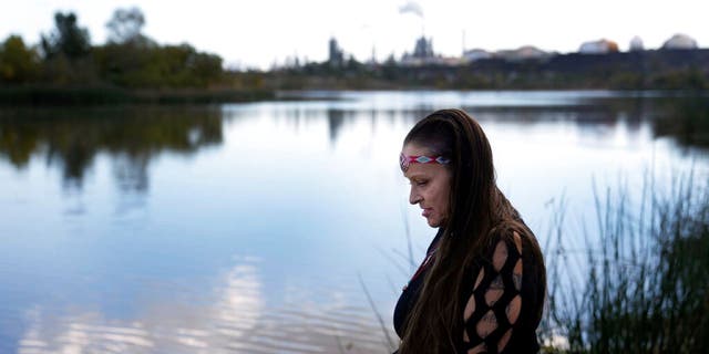 Moonlight Pulido stands by the shore at Harbor Lake Wednesday, Dec. 7, 2022, in Los Angeles. California is paying reparations to victims, mostly women, who were either forcibly or coercively sterilized by the government. Pulido was sterilized while incarcerated in 2005.