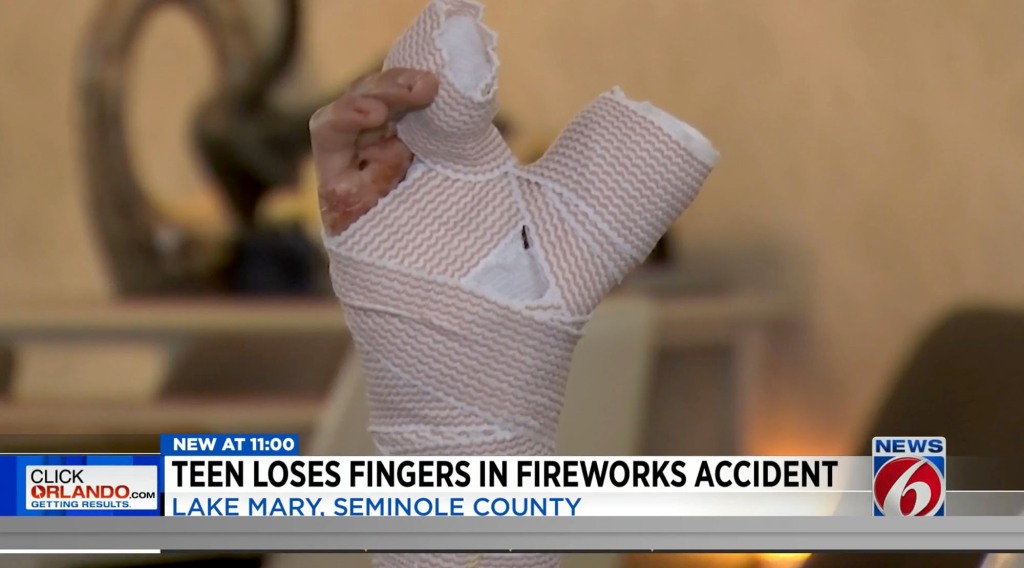 Doctors ended up having to amputate much of the teen's thumb, his index and middle fingers. 