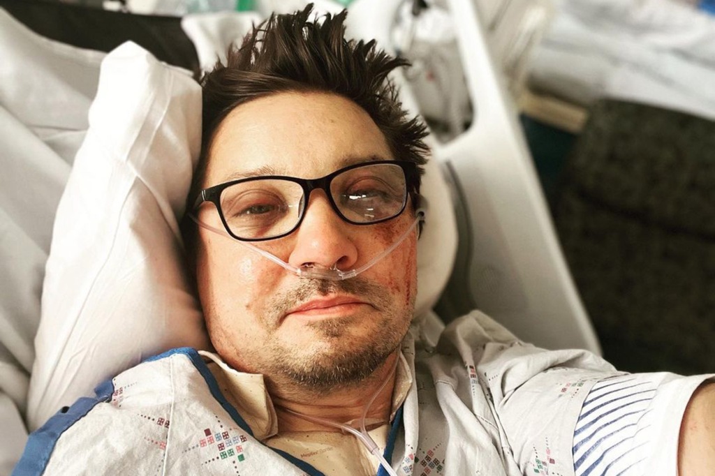 *Jeremy Renner posts photo of bruised face from hospital bed