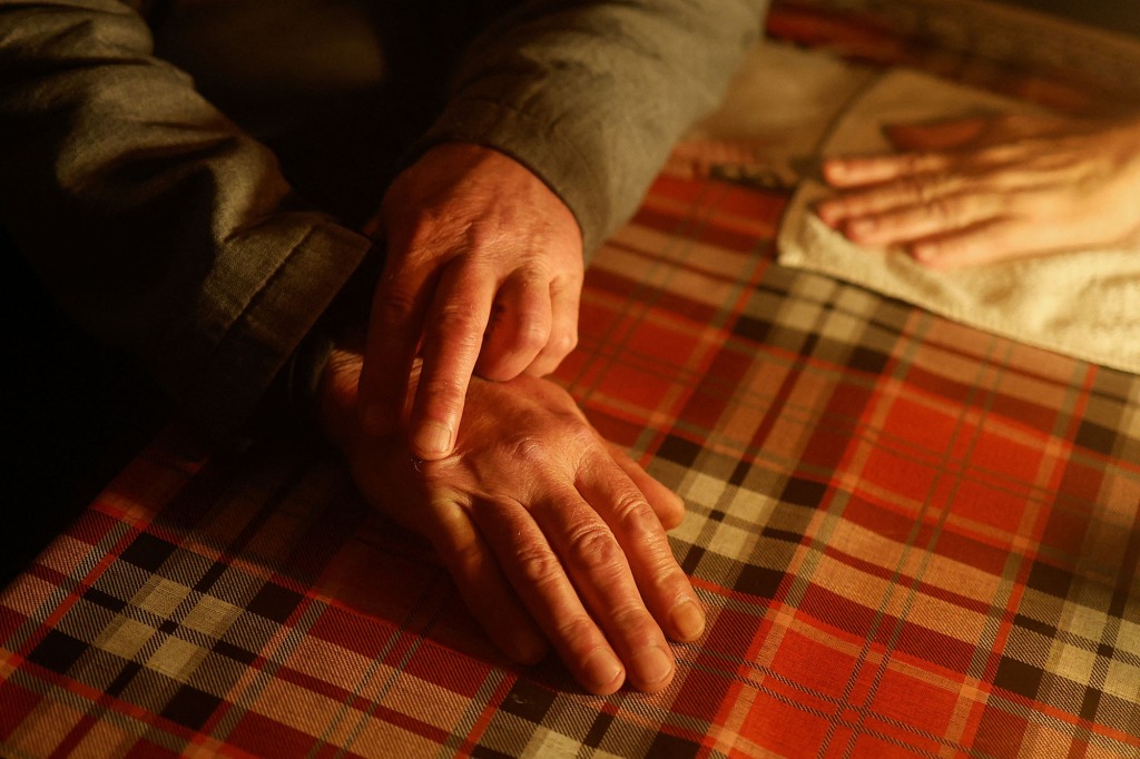 Local resident Vitalii Serdiuk, 65, shows his finger which he says was broken during torture by Russian service members.