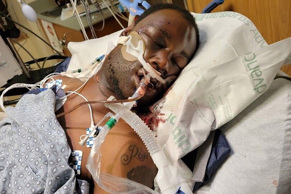 Tyre Nichols is pictured in the hospital. 