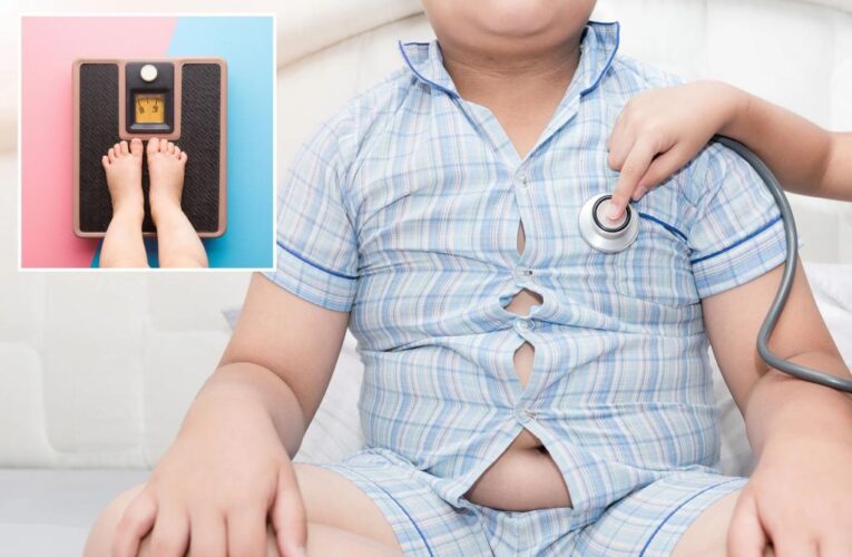 Use drugs, surgery early for obesity in kids