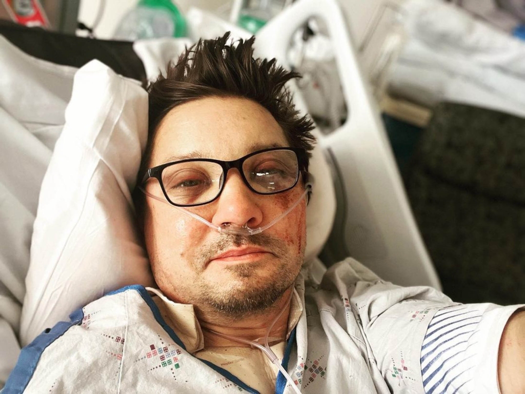 e actor later shared a photo of himself bruised and battered from the hospital bed revealing that he had suffered 30 broken bones due to the accident. The actor was released from the hospital last week. 